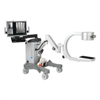 OrthoScan FD/HD mini C-Arm