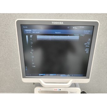 Toshiba Xario 100 Ultrasound Unit