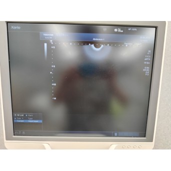 Toshiba Xario 200 Ultrasound Unit