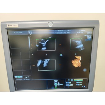 GE Voluson E8 Expert ultrasound unit