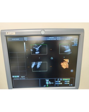 GE Voluson E8 Expert ultrasound unit