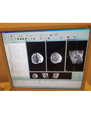 Esaote E-scan XQ 0.2T MRI scanner