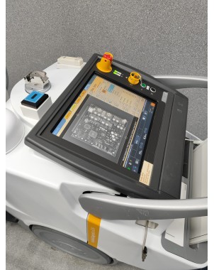 Philips MobileDiagnost wDR Mobile X-Ray Unit