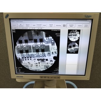 Hologic Fluoroscan InSight 2 C-Arm