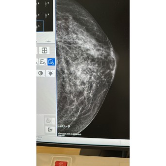 GE Senographe Pristina 3D 2017 Mammography unit