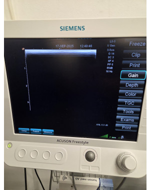 Siemens Acuson Freestyle 2014 Ultrasound Unit