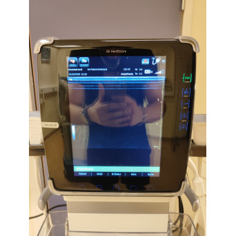 GE Healthcare Venue 40