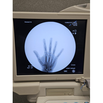 GE OEC 9900 Elite  2011